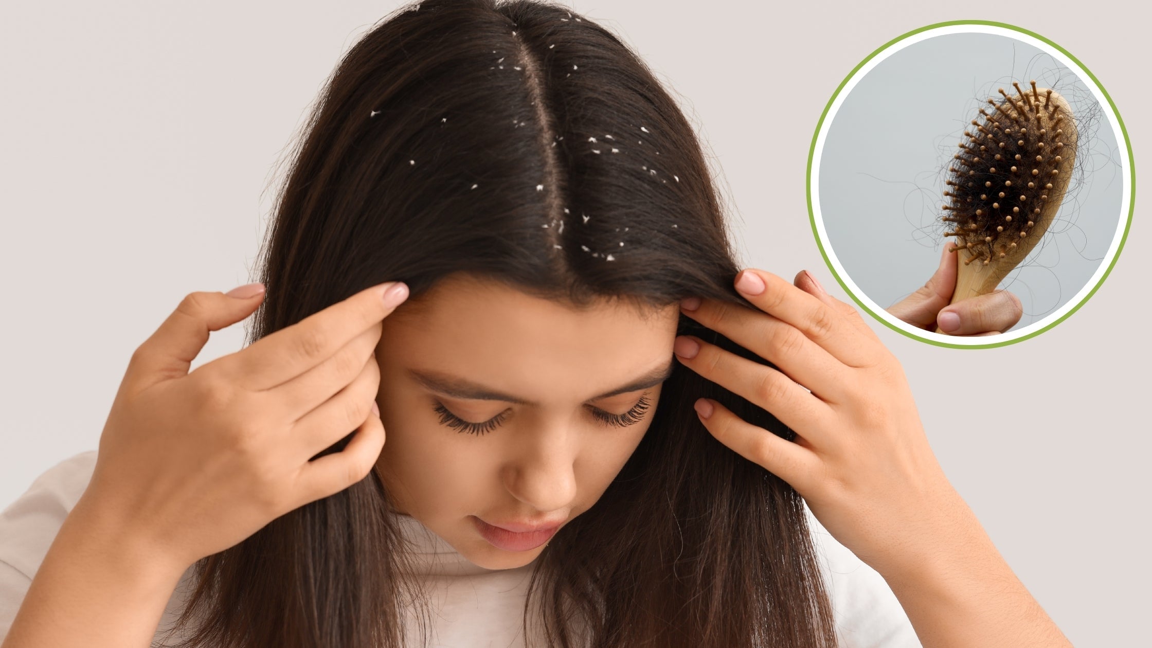 Why a Dandruff Comb works better than Regular Brushes